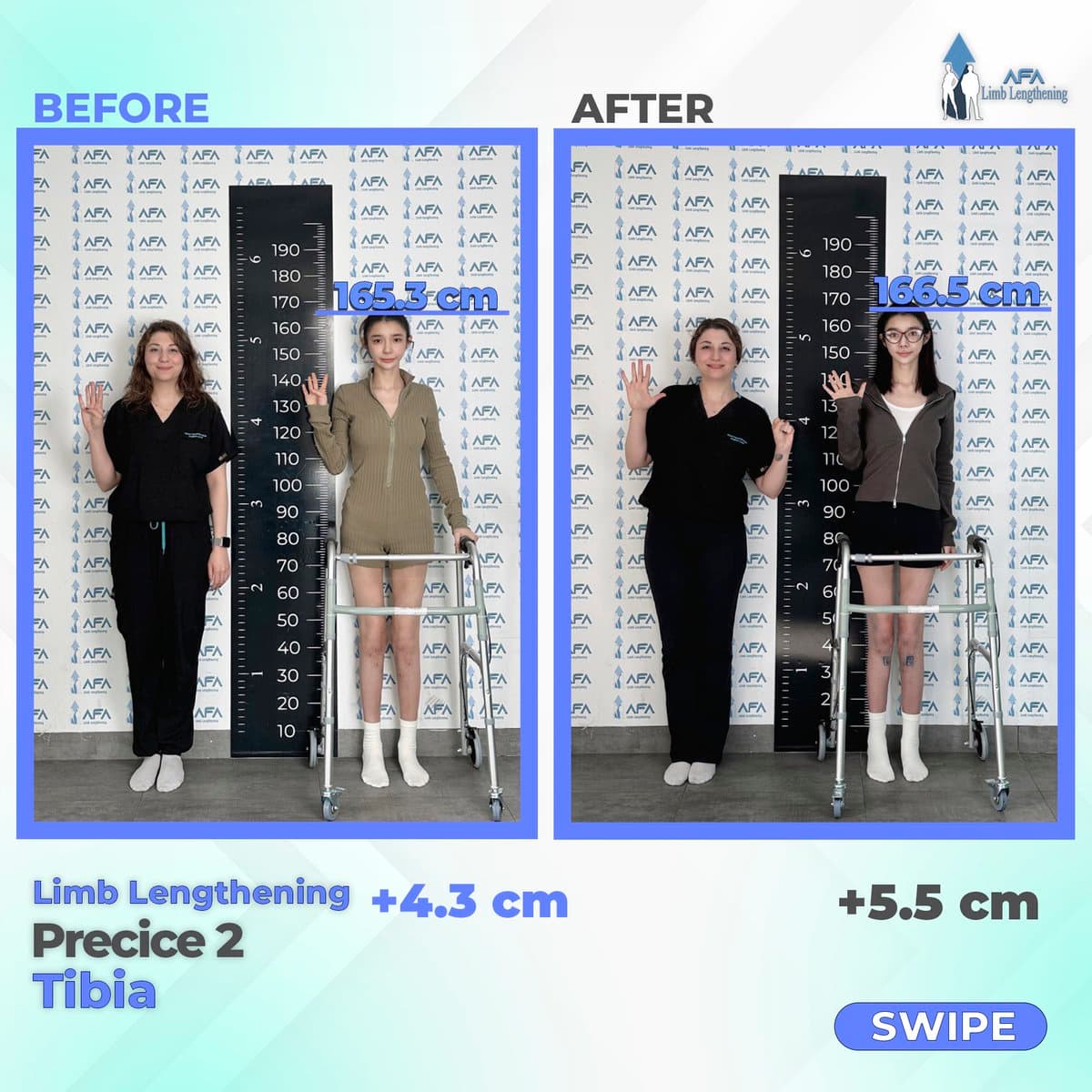 AFA Limb Lengthening — clinic photo — photo 7