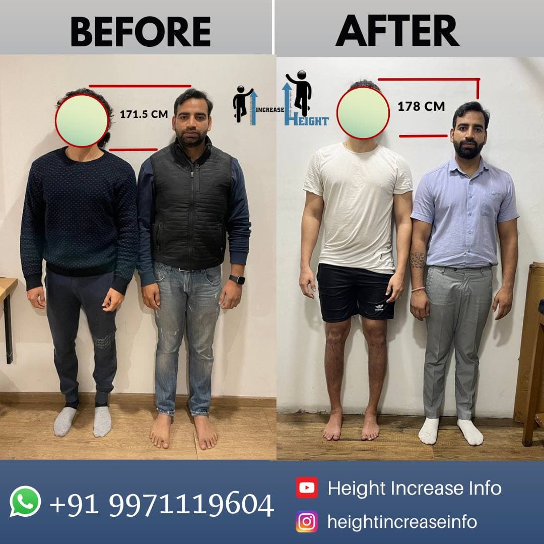 Height Increase Info — clinic photo — photo 7