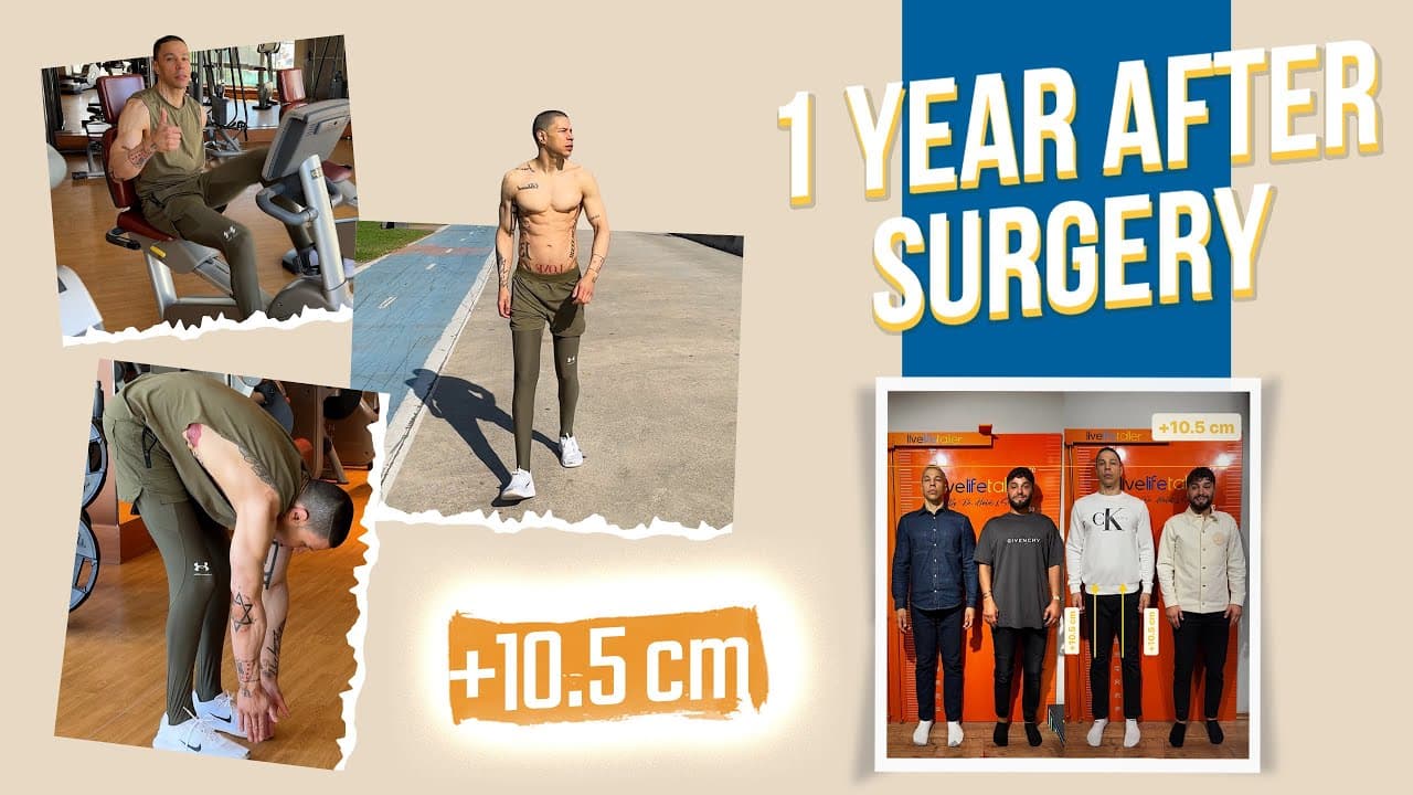 +10.5 CM HEIGHT GAIN | BEFORE SURGERY vs 1 YEAR ...