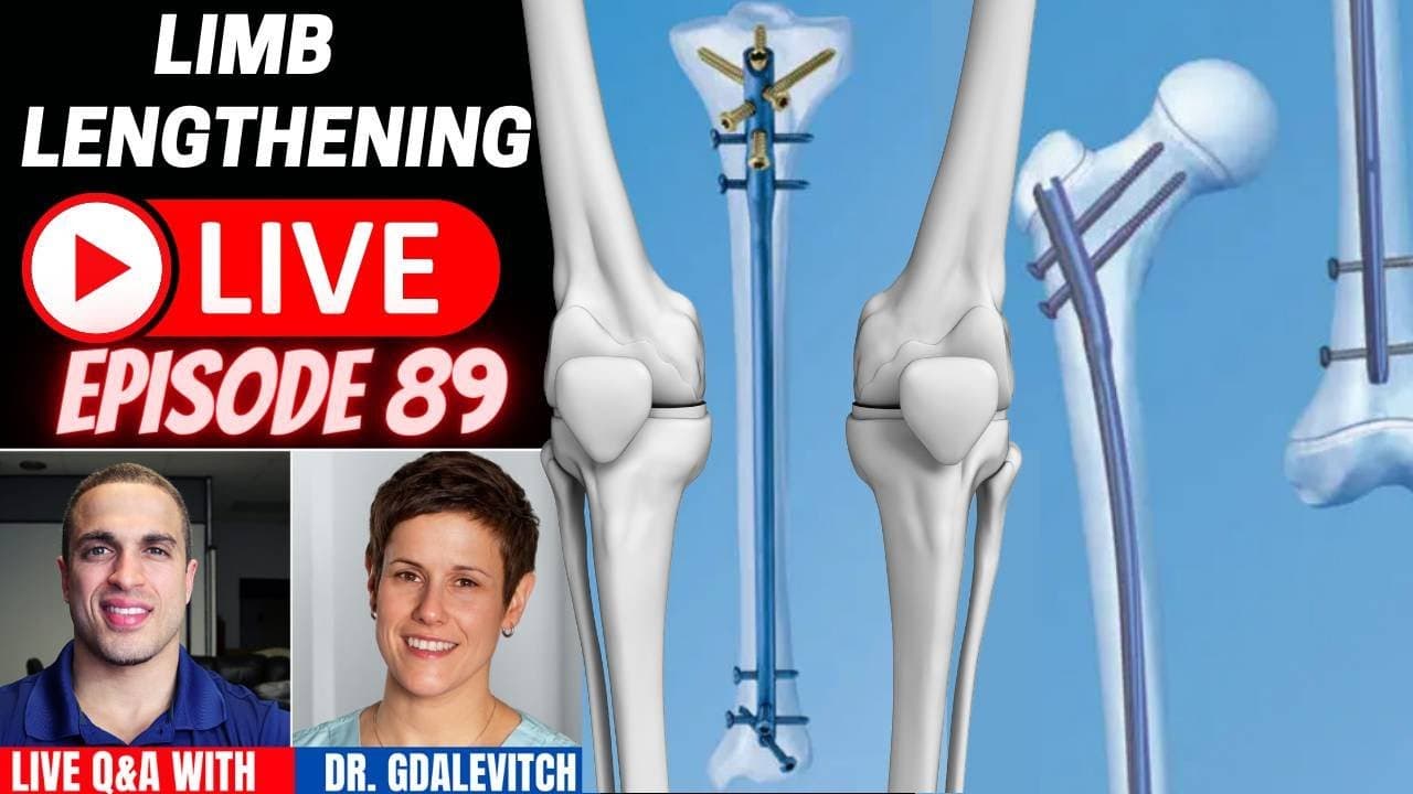 Limb Lengthening LIVE Episode 89 - Dr. Marie Gdalevitch of CLLC - Montreal Quebec Canada - YouTube