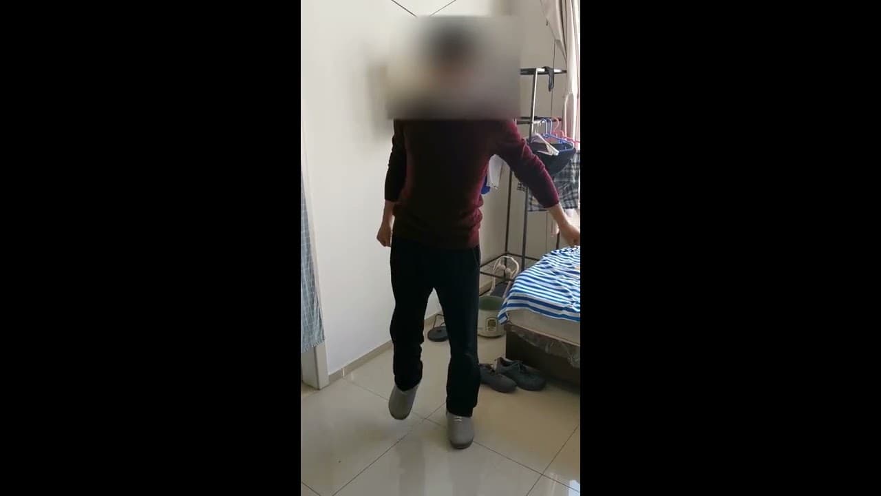 Four-Segment lengthening 6 months post op by Dr Dimitrios Giotikas. - YouTube