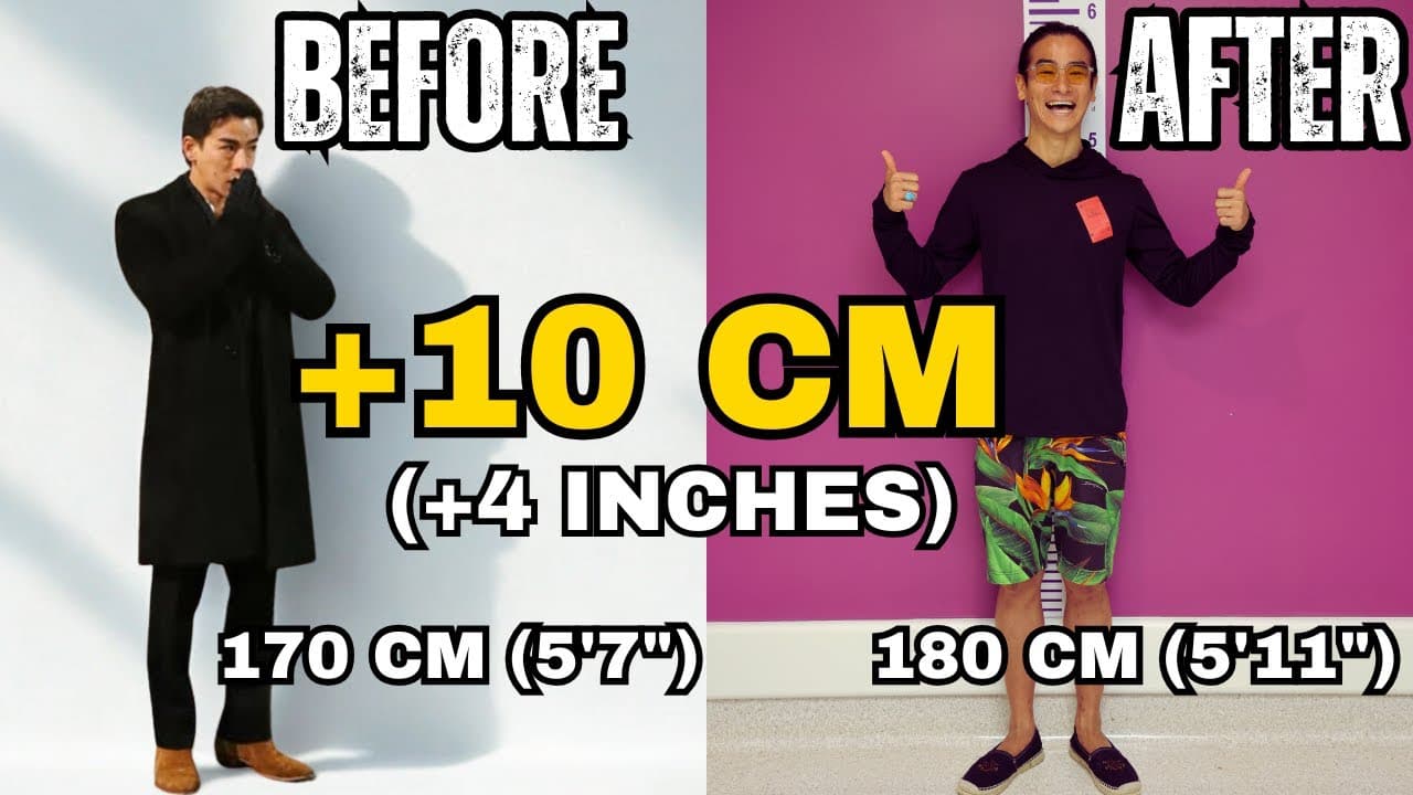 He Added 4 Inches to His Height: Ryo's Limb Lengthening ...