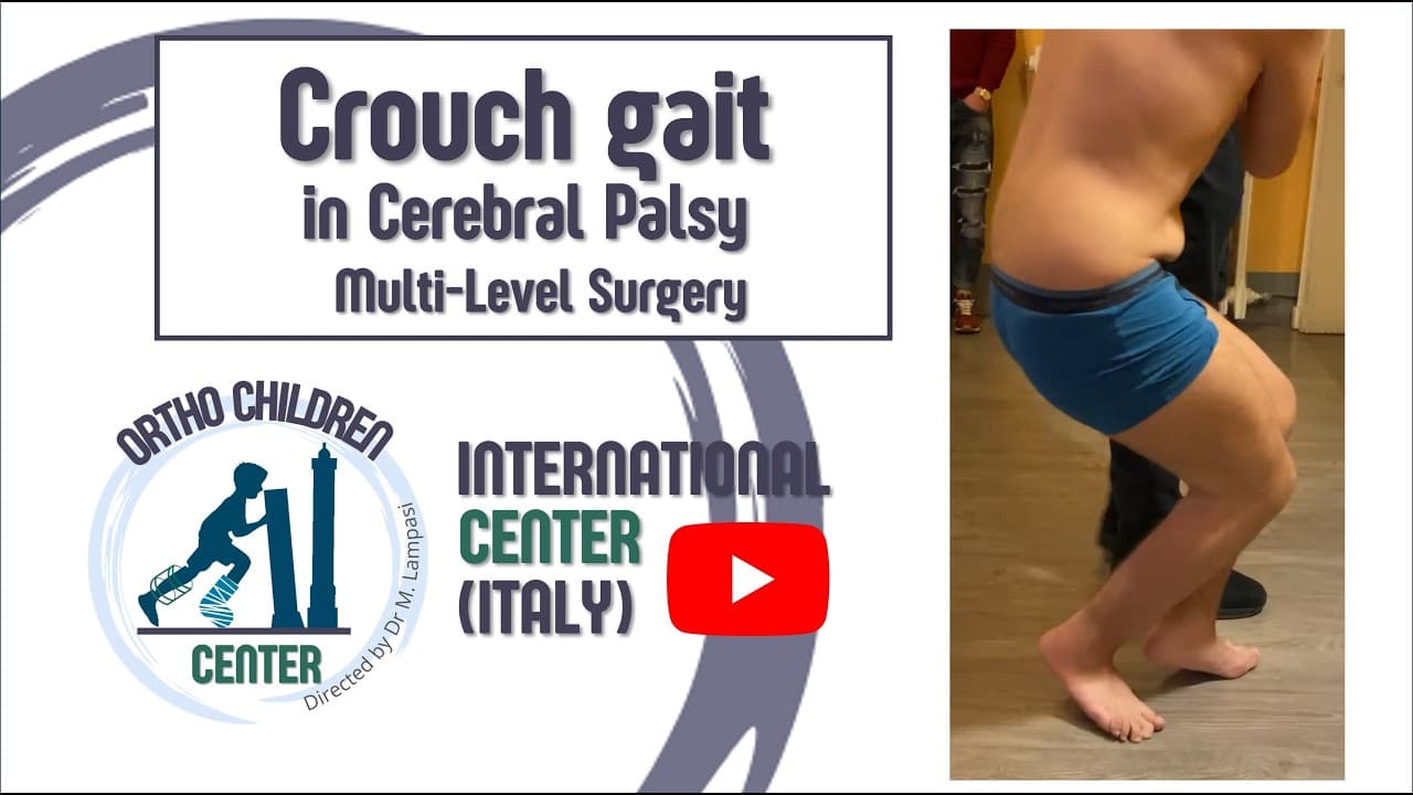 Crouch gait in Cerebral Palsy: Multi-Level Surgery (14 yrs) OrthoChildren Center (Bologna, Italy) - YouTube